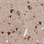 TXNDC16 Antibody in Immunohistochemistry (Paraffin) (IHC (P))