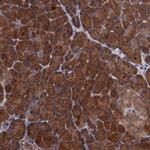 TXNDC16 Antibody in Immunohistochemistry (Paraffin) (IHC (P))