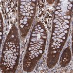 TXNDC16 Antibody in Immunohistochemistry (Paraffin) (IHC (P))