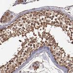 TXNDC16 Antibody in Immunohistochemistry (Paraffin) (IHC (P))