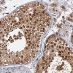 HUWE1 Antibody in Immunohistochemistry (Paraffin) (IHC (P))