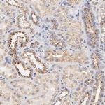 FMNL3 Antibody in Immunohistochemistry (Paraffin) (IHC (P))