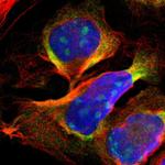 DDX24 Polyclonal Antibody