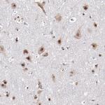 DDX24 Antibody in Immunohistochemistry (Paraffin) (IHC (P))