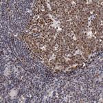 DDX24 Antibody in Immunohistochemistry (Paraffin) (IHC (P))
