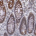 DDX24 Antibody in Immunohistochemistry (Paraffin) (IHC (P))