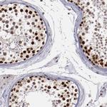 DDX24 Antibody in Immunohistochemistry (Paraffin) (IHC (P))