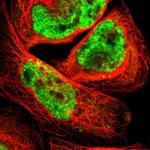 SMEK1 Polyclonal Antibody