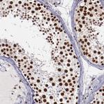 SMEK1 Antibody in Immunohistochemistry (Paraffin) (IHC (P))