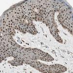 C14orf93 Antibody in Immunohistochemistry (Paraffin) (IHC (P))