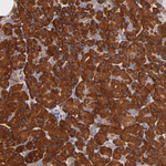 RPL27 Polyclonal Antibody
