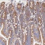 RPL30 Antibody in Immunohistochemistry (Paraffin) (IHC (P))