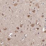 WASH1 Antibody in Immunohistochemistry (Paraffin) (IHC (P))