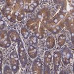 WASH1 Antibody in Immunohistochemistry (Paraffin) (IHC (P))