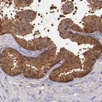 WASH1 Antibody in Immunohistochemistry (Paraffin) (IHC (P))