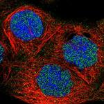 FBXO11 Polyclonal Antibody