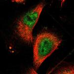 ZNF175 Polyclonal Antibody