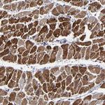 ZNF175 Antibody in Immunohistochemistry (Paraffin) (IHC (P))