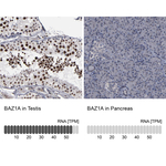 BAZ1A Polyclonal Antibody