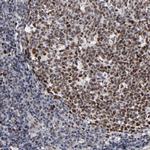 BAZ1A Antibody in Immunohistochemistry (Paraffin) (IHC (P))
