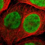 ZNF544 Polyclonal Antibody