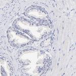 WDR65 Polyclonal Antibody