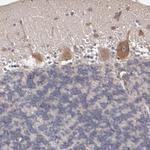 CXorf36 Antibody in Immunohistochemistry (Paraffin) (IHC (P))