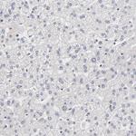 DSN1 Antibody in Immunohistochemistry (Paraffin) (IHC (P))
