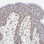 DSN1 Polyclonal Antibody