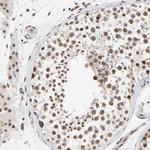 DSN1 Antibody in Immunohistochemistry (IHC)