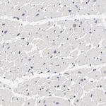 DSN1 Antibody in Immunohistochemistry (IHC)