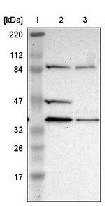 DSN1 Antibody in Western Blot (WB)