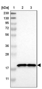NDUFB7 Antibody in Western Blot (WB)