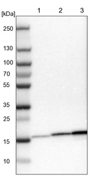 NDUFB7 Antibody in Western Blot (WB)