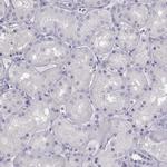 MAGEB1 Antibody in Immunohistochemistry (Paraffin) (IHC (P))