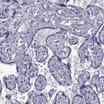 MAGEB1 Polyclonal Antibody