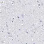 EMILIN1 Antibody in Immunohistochemistry (Paraffin) (IHC (P))