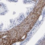 EMILIN1 Polyclonal Antibody