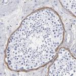 EMILIN1 Antibody in Immunohistochemistry (Paraffin) (IHC (P))