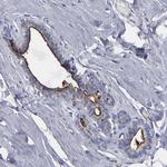 TM4SF1 Antibody in Immunohistochemistry (Paraffin) (IHC (P))