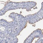 TM4SF1 Polyclonal Antibody