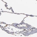TM4SF1 Antibody in Immunohistochemistry (Paraffin) (IHC (P))