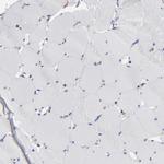 TM4SF1 Antibody in Immunohistochemistry (Paraffin) (IHC (P))