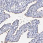 TM4SF1 Antibody in Immunohistochemistry (IHC)