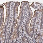 SLC15A1 Antibody in Immunohistochemistry (Paraffin) (IHC (P))