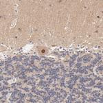 TXNL1 Antibody in Immunohistochemistry (Paraffin) (IHC (P))