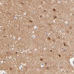 TXNL1 Antibody in Immunohistochemistry (Paraffin) (IHC (P))