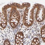 TXNL1 Antibody in Immunohistochemistry (Paraffin) (IHC (P))