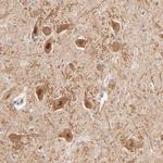 TXNL1 Antibody in Immunohistochemistry (Paraffin) (IHC (P))