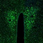 TXNL1 Antibody in Immunohistochemistry (Paraffin) (IHC (P))